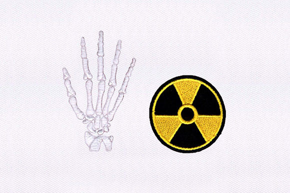 Radiation Hand Bones Design Review: Real Project Insights